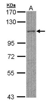 MYBPC2 Antibody - Sample (30 ug of whole cell lysate). A: Hela S3. 7.5 % SDS PAGE. MYBPC2 antibody diluted at 1:500