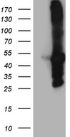 MYBPC2 Antibody - HEK293T cells were transfected with the pCMV6-ENTRY control. (Left lane) or pCMV6-ENTRY MYBPC2. (Right lane) cDNA for 48 hrs and lysed. Equivalent amounts of cell lysates. (5 ug per lane) were separated by SDS-PAGE and immunoblotted with anti-MYBPC2. (1:2000)
