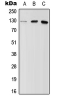MYBPC2 Antibody - Western blot analysis of MYBPC2 expression in HeLa (A); NIH3T3 (B); H9C2 (C) whole cell lysates.
