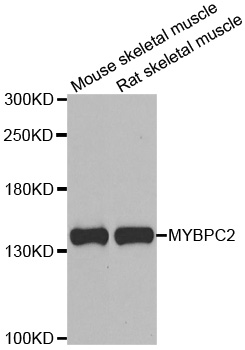 MYBPC2 Antibody - Western blot analysis of extracts of various cell lines.