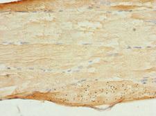 MYBPC2 Antibody - Immunohistochemistry of paraffin-embedded human skeletal muscle tissue at dilution 1:100