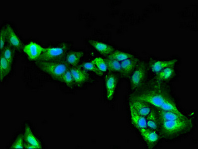 MYBPC2 Antibody - Immunofluorescent analysis of Hela cells diluted at 1:100 and Alexa Fluor 488-congugated AffiniPure Goat Anti-Rabbit IgG(H+L)