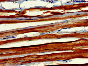 MYBPC2 Antibody - Immunohistochemistry of paraffin-embedded human skeletal muscle tissue at dilution of 1:100