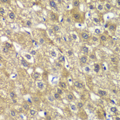 MYBPC2 Antibody - Immunohistochemistry of paraffin-embedded human liver injury using MYBPC2 antibody at dilution of 1:100 (40x lens).