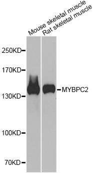 MYBPC2 Antibody - Western blot analysis of extracts of various cell lines, using MYBPC2 antibody at 1:1000 dilution. The secondary antibody used was an HRP Goat Anti-Rabbit IgG (H+L) at 1:10000 dilution. Lysates were loaded 25ug per lane and 3% nonfat dry milk in TBST was used for blocking. An ECL Kit was used for detection and the exposure time was 90s.