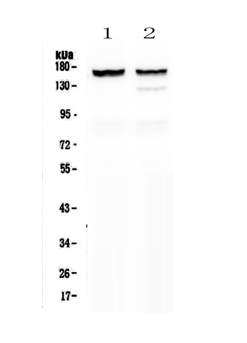 MYBPC3 / MYBP-C Antibody - Western blot - Anti-MYBPC3 Picoband antibody