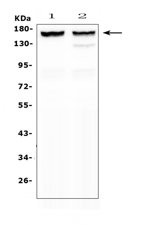 MYBPC3 / MYBP-C Antibody - Western blot analysis of MYBPC3 using anti-MYBPC3 antibody. Electrophoresis was performed on a 5-20% SDS-PAGE gel at 70V (Stacking gel) / 90V (Resolving gel) for 2-3 hours. The sample well of each lane was loaded with 50ug of sample under reducing conditions. Lane 1: rat heart tissue lysates,Lane 2: mouse heart tissue lysates. After Electrophoresis, proteins were transferred to a Nitrocellulose membrane at 150mA for 50-90 minutes. Blocked the membrane with 5% Non-fat Milk/ TBS for 1.5 hour at RT. The membrane was incubated with rabbit anti-MYBPC3 antigen affinity purified polyclonal antibody at 0.5 µg/mL overnight at 4°C, then washed with TBS-0.1% Tween 3 times with 5 minutes each and probed with a goat anti-rabbit IgG-HRP secondary antibody at a dilution of 1:10000 for 1.5 hour at RT. The signal is developed using an Enhanced Chemiluminescent detection (ECL) kit with Tanon 5200 system. A specific band was detected for MYBPC3 at approximately 160KD. The expected band size for MYBPC3 is at 147KD.