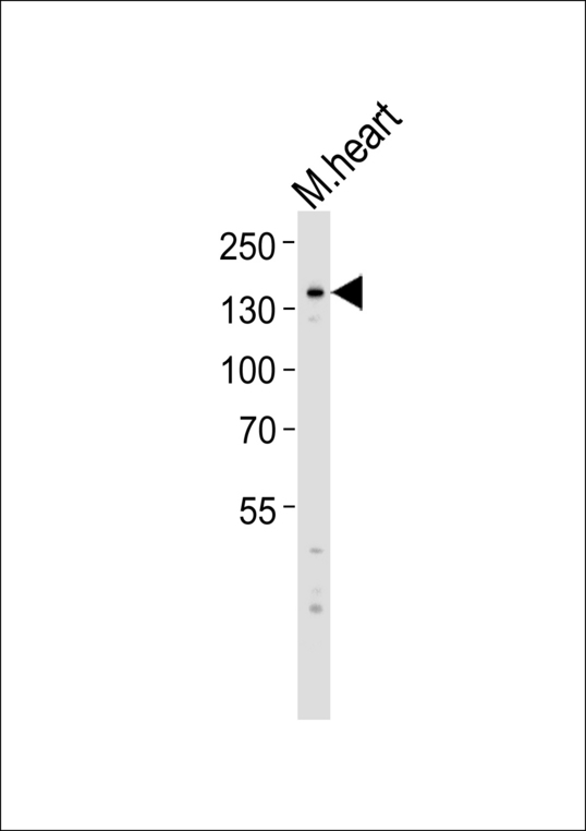 MYBPC3 / MYBP-C Antibody - Western blot of lysate from mouse heart tissue lysate, using MYBPC3 Antibody. Antibody was diluted at 1:1000. A goat anti-rabbit IgG H&L (HRP) at 1:5000 dilution was used as the secondary antibody. Lysate at 35ug.