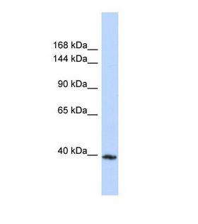 MYBPC3 / MYBP-C Antibody - Western blot of Human MCF7. MYBPC3 antibody dilution 1.0 ug/ml.  This image was taken for the unconjugated form of this product. Other forms have not been tested.