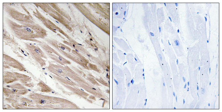 MYBPC3 / MYBP-C Antibody - Immunohistochemistry analysis of paraffin-embedded human heart tissue, using MYBPC3 Antibody. The picture on the right is blocked with the synthesized peptide.