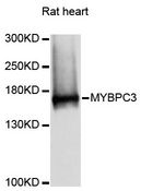 MYBPC3 / MYBP-C Antibody - Western blot analysis of extracts of rat heart, using MYBPC3 antibody at 1:3000 dilution. The secondary antibody used was an HRP Goat Anti-Rabbit IgG (H+L) at 1:10000 dilution. Lysates were loaded 25ug per lane and 3% nonfat dry milk in TBST was used for blocking. An ECL Kit was used for detection and the exposure time was 1s.