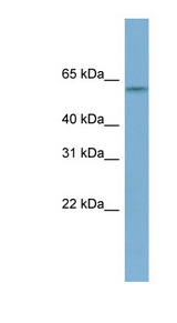 MYBPH Antibody - MYBPH antibody Western blot of HeLa lysate. This image was taken for the unconjugated form of this product. Other forms have not been tested.