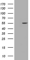 MYBPH Antibody - HEK293T cells were transfected with the pCMV6-ENTRY control (Left lane) or pCMV6-ENTRY MYBPH (Right lane) cDNA for 48 hrs and lysed. Equivalent amounts of cell lysates (5 ug per lane) were separated by SDS-PAGE and immunoblotted with anti-MYBPH.