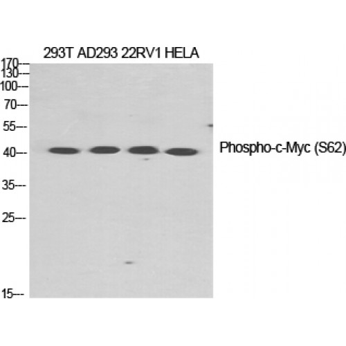 MYC / c-Myc Antibody - Western blot of Phospho-c-Myc (S62) antibody