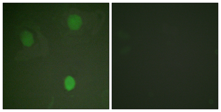 MYC / c-Myc Antibody - Immunofluorescence analysis of HeLa cells, using MYC Antibody. The picture on the right is blocked with the synthesized peptide.
