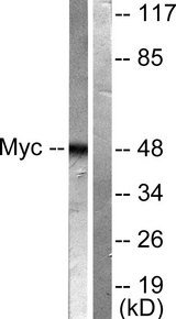 MYC / c-Myc Antibody - Western blot analysis of lysates from HeLa cells, treated with Forskolin 40nM 30', using MYC Antibody. The lane on the right is blocked with the synthesized peptide.