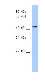 MYC / c-Myc Antibody - MYC / c-Myc antibody Western blot of HT1080 cell lysate. This image was taken for the unconjugated form of this product. Other forms have not been tested.