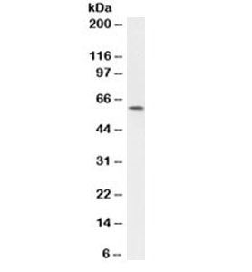 MYC / c-Myc Antibody - Western blot testing of HeLa cell lysate (nuclear fraction) with Myc antibody (clone SPM237). Theoretical molecular weight: ~50kDa but routinely observed at 50~70kDa.