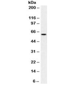 MYC / c-Myc Antibody - Western blot testing of HeLa cell lysate (nuclear fraction) with c-Myc antibody (clone 9E10.3). Theoretical molecular weight: ~50kDa but routinely observed at 50~70kDa.
