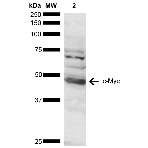 MYC / c-Myc Antibody - Western blot analysis of Human Cervical cancer cell line (HeLa) lysate showing detection of ~48.8 kDa c-Myc protein using Rabbit Anti-c-Myc Polyclonal Antibody. Lane 1: Molecular Weight Ladder (MW). Lane 2: Cervical Cancer cell line (HeLa) lysate. Load: 10 µg. Block: 5% Skim Milk in 1X TBST. Primary Antibody: Rabbit Anti-c-Myc Polyclonal Antibody  at 1:1000 for 2 hours at RT. Secondary Antibody: Goat Anti-Rabbit HRP:IgG at 1:3000 for 1 hour at RT. Color Development: ECL solution for 5 min at RT. Predicted/Observed Size: ~48.8 kDa. Other Band(s): due to post translational modifications.