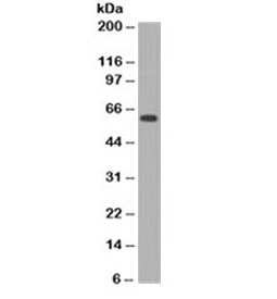 MYC / c-Myc Antibody - Western blot testing of HeLa cell lysate (nuclear fraction) with c-Myc antibody (clone MVH39-1). Expected molecular weight: 50~70kDa.