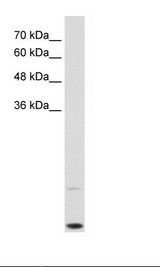MYC / c-Myc Antibody - HepG2 Cell Lysate.  This image was taken for the unconjugated form of this product. Other forms have not been tested.
