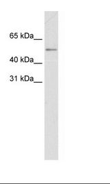 MYC / c-Myc Antibody - Fetal small Intestine Lysate.  This image was taken for the unconjugated form of this product. Other forms have not been tested.