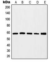 MYC / c-Myc Antibody - Western blot analysis of c-Myc expression in HEK293A (A); Jurkat (B); K562 (C); HeLa (D); NIH3T3 (E) whole cell lysates.
