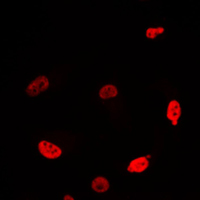 MYC / c-Myc Antibody - Immunofluorescent analysis of c-Myc staining in Jurkat cells. Formalin-fixed cells were permeabilized with 0.1% Triton X-100 in TBS for 5-10 minutes and blocked with 3% BSA-PBS for 30 minutes at room temperature. Cells were probed with the primary antibody in 3% BSA-PBS and incubated overnight at 4 C in a humidified chamber. Cells were washed with PBST and incubated with a DyLight 594-conjugated secondary antibody (red) in PBS at room temperature in the dark. DAPI was used to stain the cell nuclei (blue).