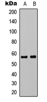 MYC / c-Myc Antibody - Western blot analysis of c-Myc expression in K562 (A); NIH3T3 (B) whole cell lysates.