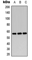 MYC / c-Myc Antibody - Western blot analysis of c-Myc (pT358) expression in HeLa (A); HEK293T EGF-treated (B); A431 (C) whole cell lysates.