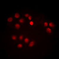 MYC / c-Myc Antibody - Immunofluorescent analysis of c-Myc (pT358) staining in HeLa cells. Formalin-fixed cells were permeabilized with 0.1% Triton X-100 in TBS for 5-10 minutes and blocked with 3% BSA-PBS for 30 minutes at room temperature. Cells were probed with the primary antibody in 3% BSA-PBS and incubated overnight at 4 deg C in a humidified chamber. Cells were washed with PBST and incubated with a DyLight 594-conjugated secondary antibody (red) in PBS at room temperature in the dark. DAPI was used to stain the cell nuclei (blue).