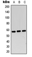 MYC / c-Myc Antibody - Western blot analysis of c-Myc expression in A549 (A); Jurkat (B); NIH3T3 (C) whole cell lysates.