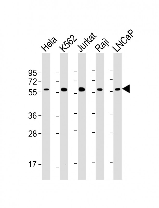 MYC / c-Myc Antibody - All lanes: Anti-MYC Antibody at 1:2000 dilution Lane 1: Hela whole cell lysate Lane 2: K562 whole cell lysate Lane 3: Jurkat whole cell lysate Lane 4: Raji whole cell lysate Lane 5: LNCaP whole cell lysate Lysates/proteins at 20 µg per lane. Secondary Goat Anti-mouse IgG, (H+L), Peroxidase conjugated at 1/10000 dilution. Predicted band size: 51 kDa Blocking/Dilution buffer: 5% NFDM/TBST.