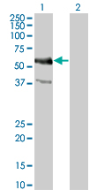MYC / c-Myc Antibody - Western blot of MYC expression in transfected 293T cell line by MYC monoclonal antibody (M02), clone 1G7.