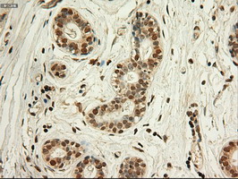 MYC / c-Myc Antibody - IHC of paraffin-embedded Human breast tissue using anti-MYC mouse monoclonal antibody.