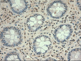 MYC / c-Myc Antibody - IHC of paraffin-embedded Human colon tissue using anti-MYC mouse monoclonal antibody.
