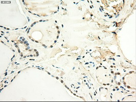 MYC / c-Myc Antibody - IHC of paraffin-embedded Human thyroid tissue using anti-MYC mouse monoclonal antibody.