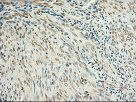 MYC / c-Myc Antibody - IHC of paraffin-embedded Human endometrium tissue using anti-MYC mouse monoclonal antibody.