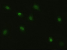 MYC / c-Myc Antibody - Immunofluorescent staining of HeLa cells using anti-MYC mouse monoclonal antibody.