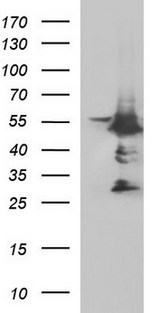MYC / c-Myc Antibody - HEK293T cells were transfected with the pCMV6-ENTRY control (Left lane) or pCMV6-ENTRY MYC (Right lane) cDNA for 48 hrs and lysed. Equivalent amounts of cell lysates (5 ug per lane) were separated by SDS-PAGE and immunoblotted with anti-MYC.