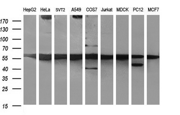 MYC / c-Myc Antibody - Western blot of extracts (35ug) from 9 different cell lines by using anti-MYC monoclonal antibody (HepG2: human; HeLa: human; SVT2: mouse; A549: human; COS7: monkey; Jurkat: human; MDCK: canine; PC12: rat; MCF7: human).