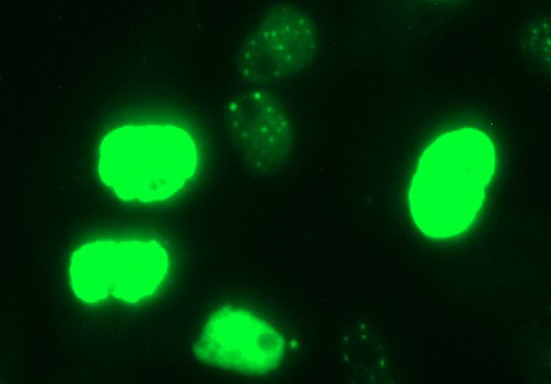MYC / c-Myc Antibody - Anti-MYC mouse monoclonal antibody immunofluorescent staining of COS7 cells transiently transfected by pCMV6-ENTRY MYC.