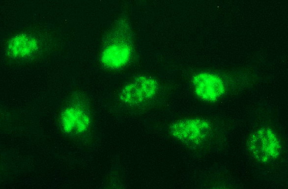 MYC / c-Myc Antibody - Immunofluorescent staining of HeLa cells using anti-MYC mouse monoclonal antibody.