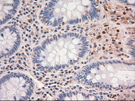 MYC / c-Myc Antibody - IHC of paraffin-embedded Human colon tissue using anti-MYC mouse monoclonal antibody.