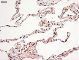 MYC / c-Myc Antibody - IHC of paraffin-embedded Human lung tissue using anti-MYC mouse monoclonal antibody.