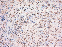 MYC / c-Myc Antibody - IHC of paraffin-embedded Human endometrium tissue using anti-MYC mouse monoclonal antibody.