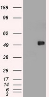 MYC / c-Myc Antibody - c-myc antibody (5G3) at 1:1000 with Hela cell lysate.