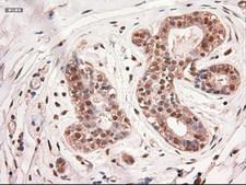 MYC / c-Myc Antibody - IHC of paraffin-embedded Human breast tissue using anti-MYC mouse monoclonal antibody.