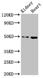 MYC / c-Myc Antibody - Western Blot Positive WB detected in: Mouse kidney tissue, Mouse heart tissue All lanes: MYC antibody at 2.7µg/ml Secondary Goat polyclonal to rabbit IgG at 1/50000 dilution Predicted band size: 49 kDa Observed band size: 49 kDa